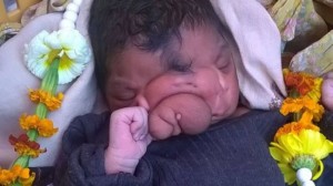 bayi berbelalai